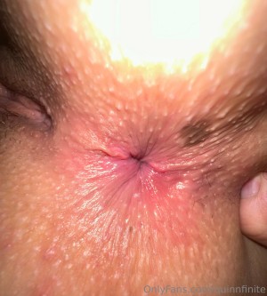 Quinn Finite Photo #318