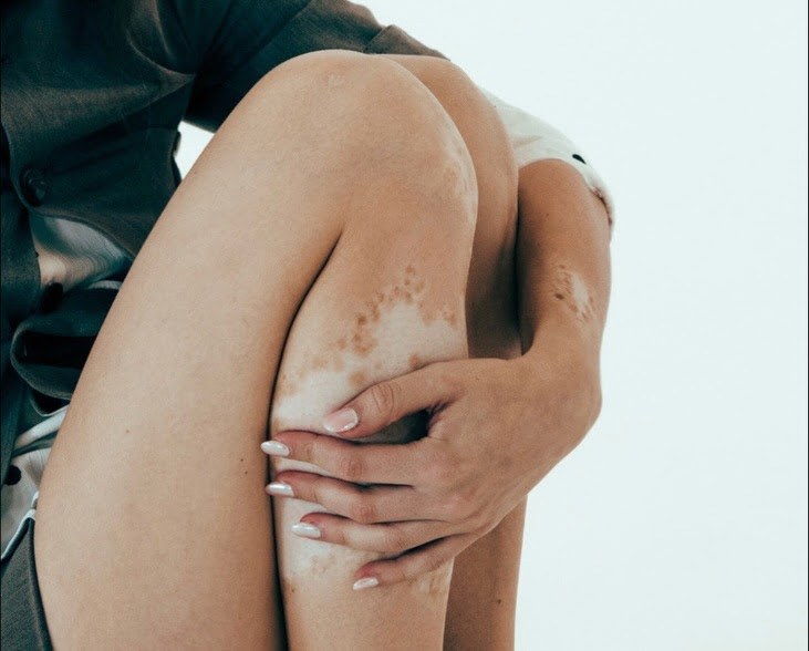 Nadine Breaty Photo #83
