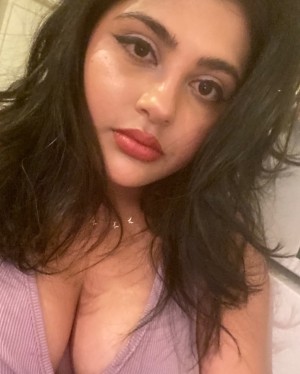 vitiligo kitten Nude Leaks OnlyFans Photos #1