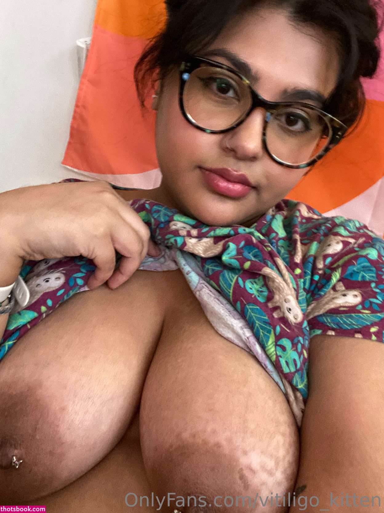 vitiligo kitten Nude Leaks OnlyFans Photos #3 1914277