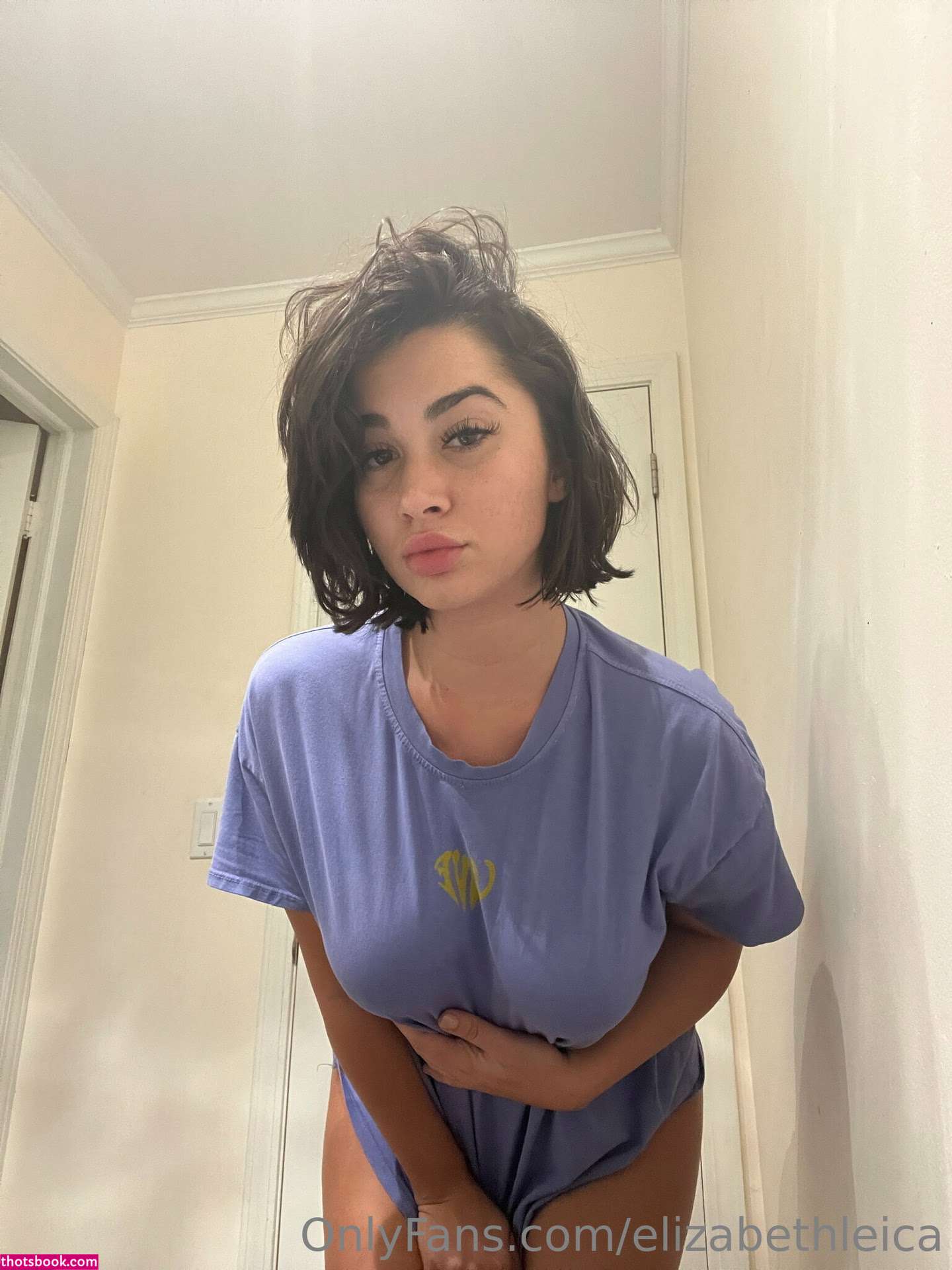 Lupuwellness OnlyFans Photos #1 154936