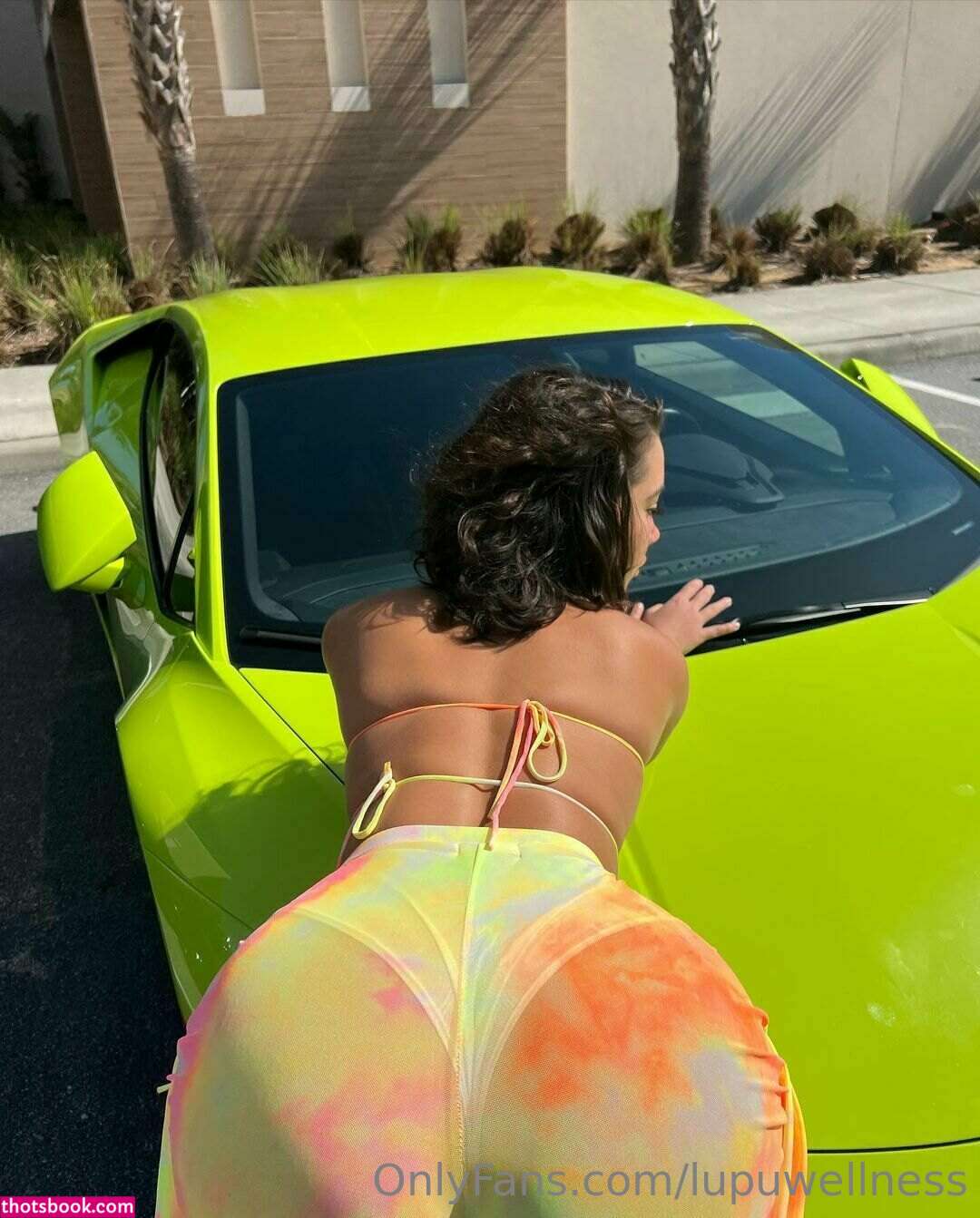 Lupuwellness OnlyFans Photos #2 154952